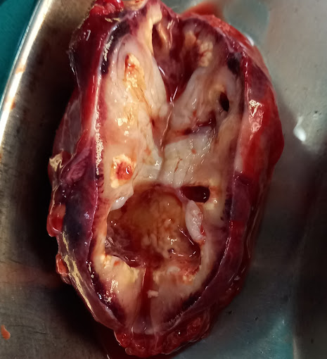 Urology Laser Equipment